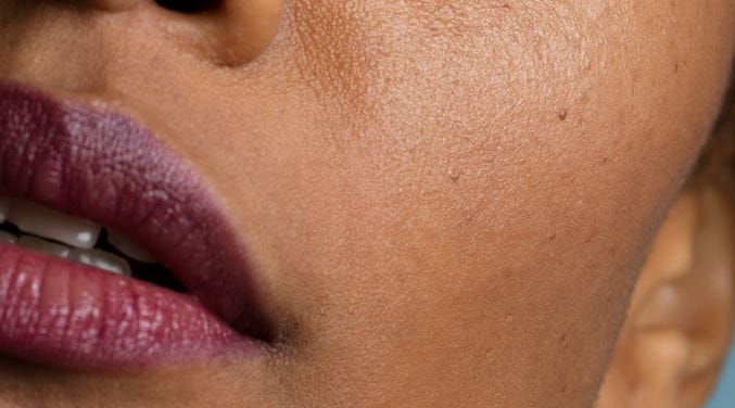 Verschillende soorten lippen