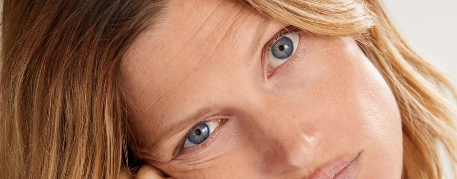 Blog Artigo 35 - Rugas: o que é e como tratar