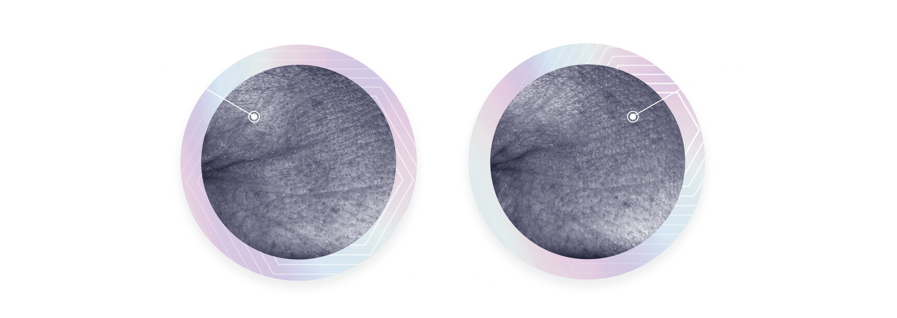 Une image avant/après compare deux photos des rides du coin des yeux, à côté du texte : « Inversez les signes visibles de l'âge en 2 semaines ».