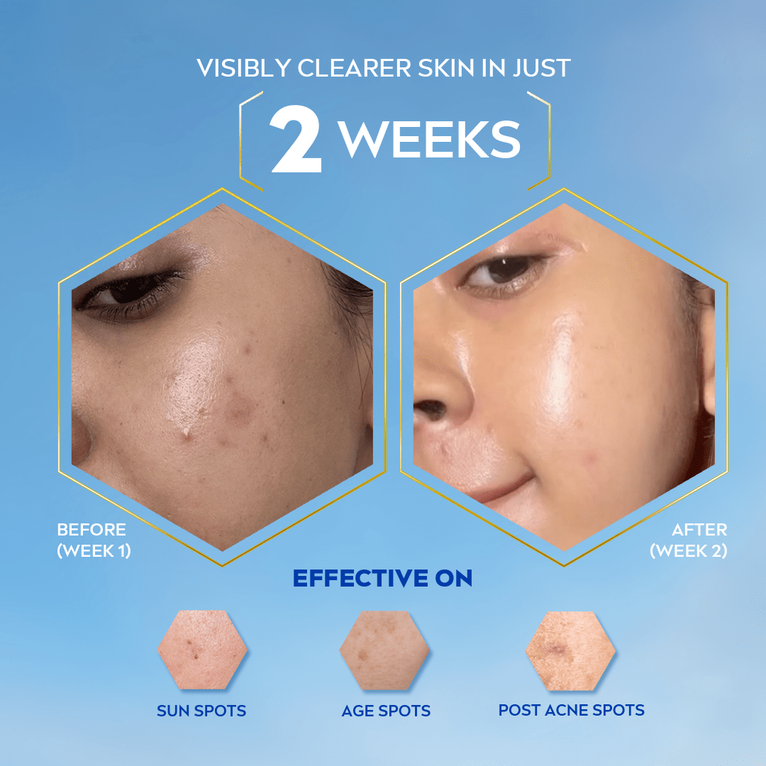 Luminous 630 Oil Control Serum