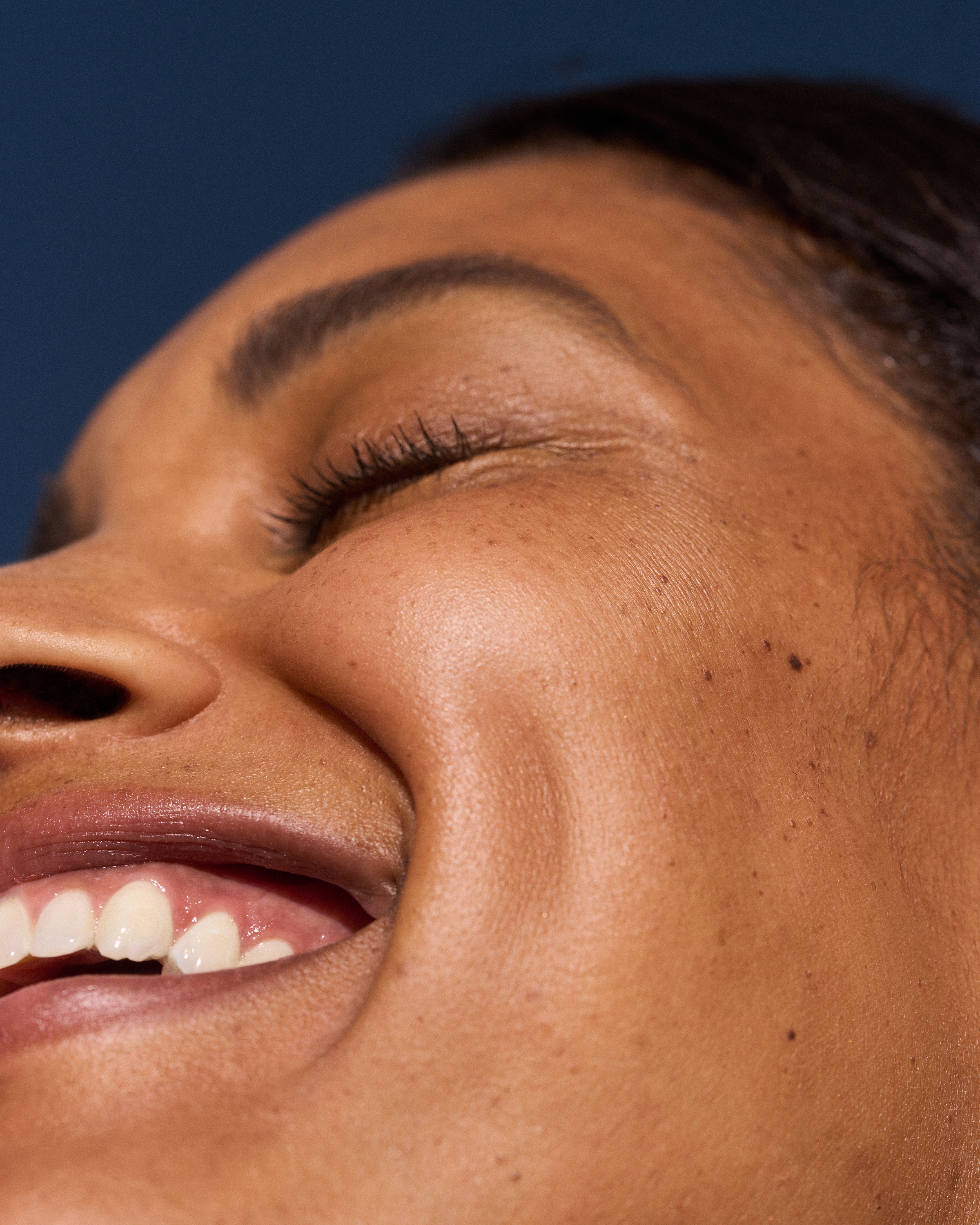 Naturally beautiful skin