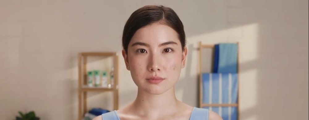 Blog Artigo 11 - O que causa acne