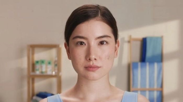 Blog Artigo 11 - O que causa acne