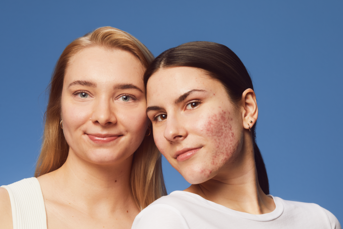 Dwie kobiety pozujące w naturalnym stylu