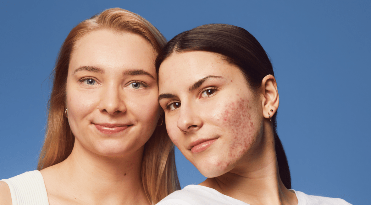 Zwei Frauen posieren mit natürlichem Aussehen