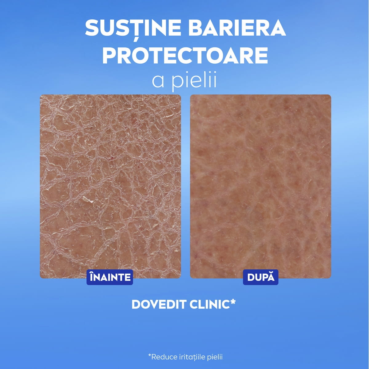 NIVEA Repair & Care Body Serum Lotion benefits include 72h+ intensive moisture and repairs 5 signs of dry skin* from 1st use