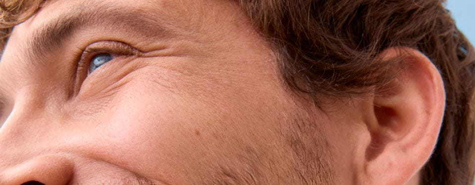 uomo con borse sotto gli occhi
