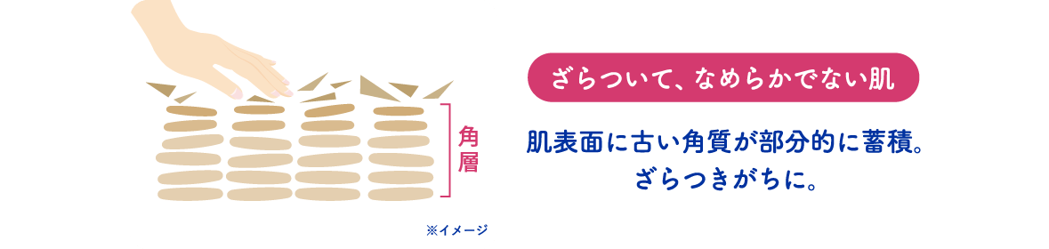 ざらついて、なめらかでない肌。肌表面に古い角質が部分的に蓄積。 ざらつきがちに。