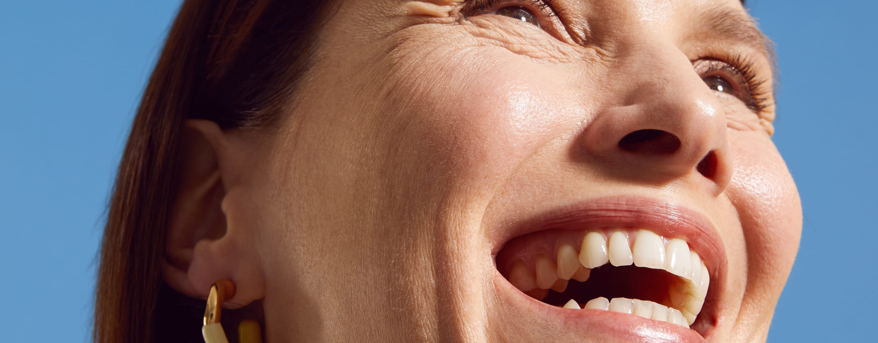 naso congelato per il freddo