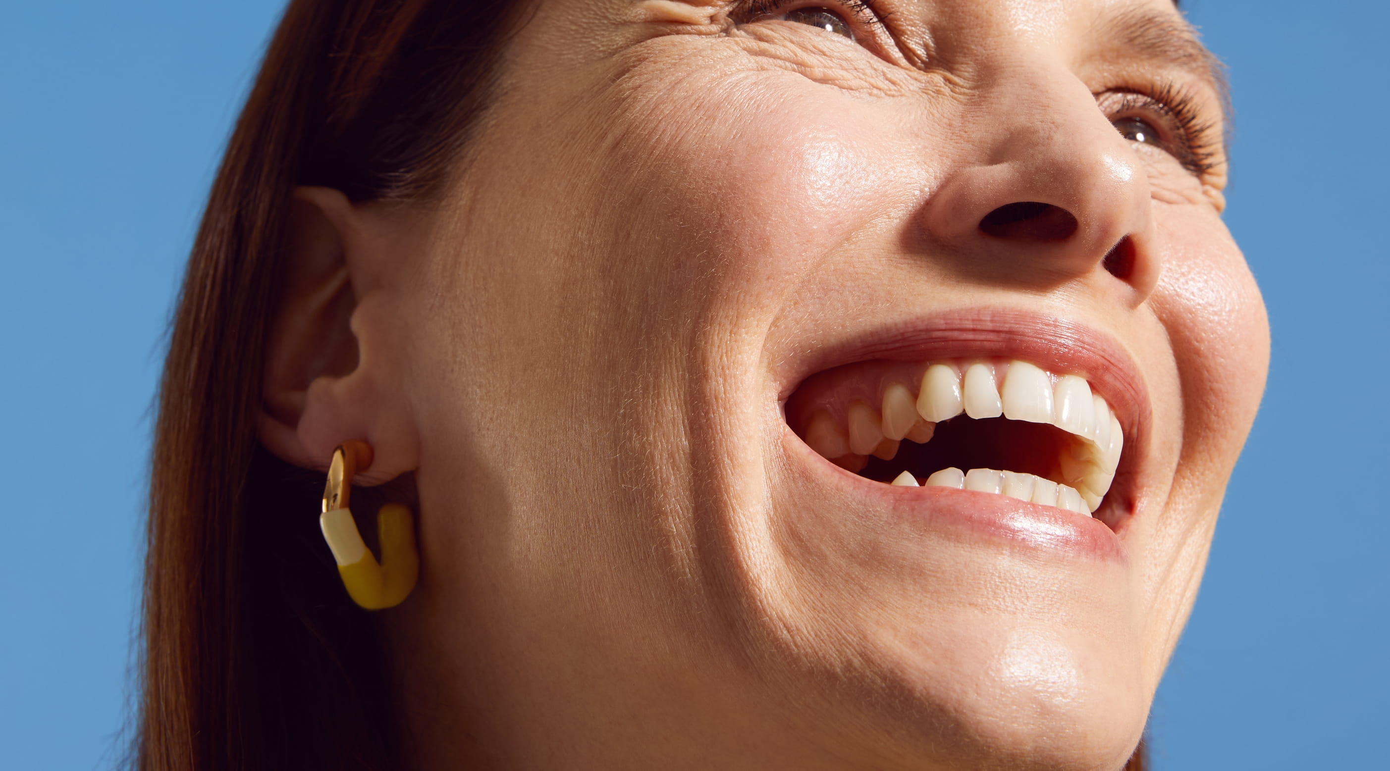 naso congelato per il freddo