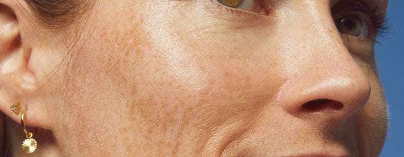 γυναίκα κοιτάζει μπροστά