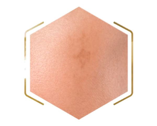 LP Orionis