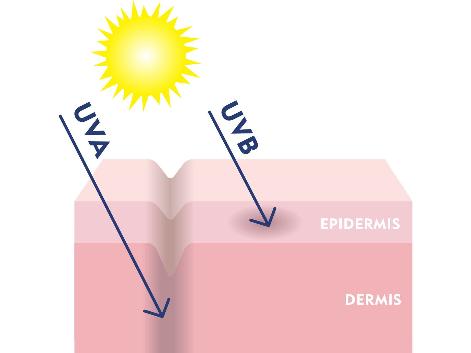 รังสี UVA และ UVB ส่งผลต่อผิวเราอย่างไร?