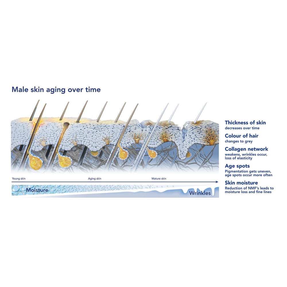 กรดไฮยาลูรอนิก