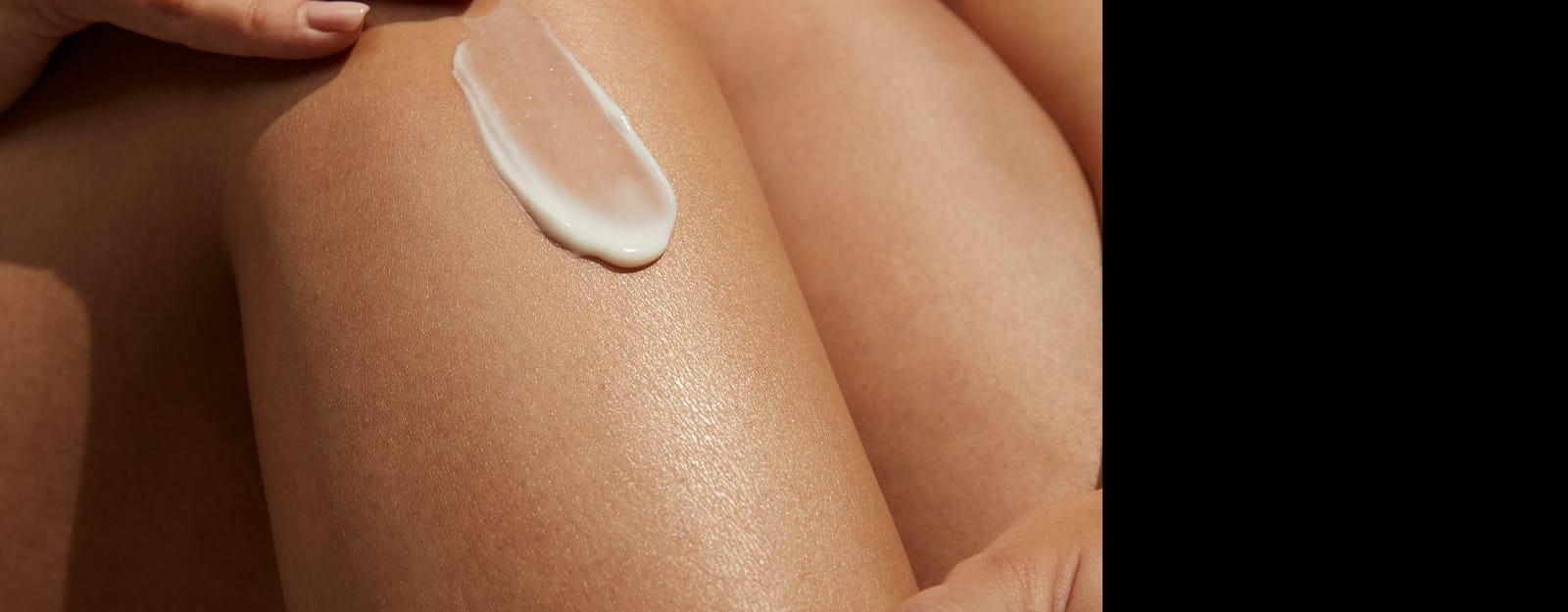 Frau mit erwachsener Akne