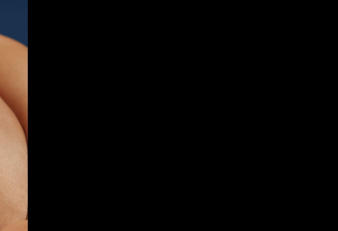 What causes an itchy beard?