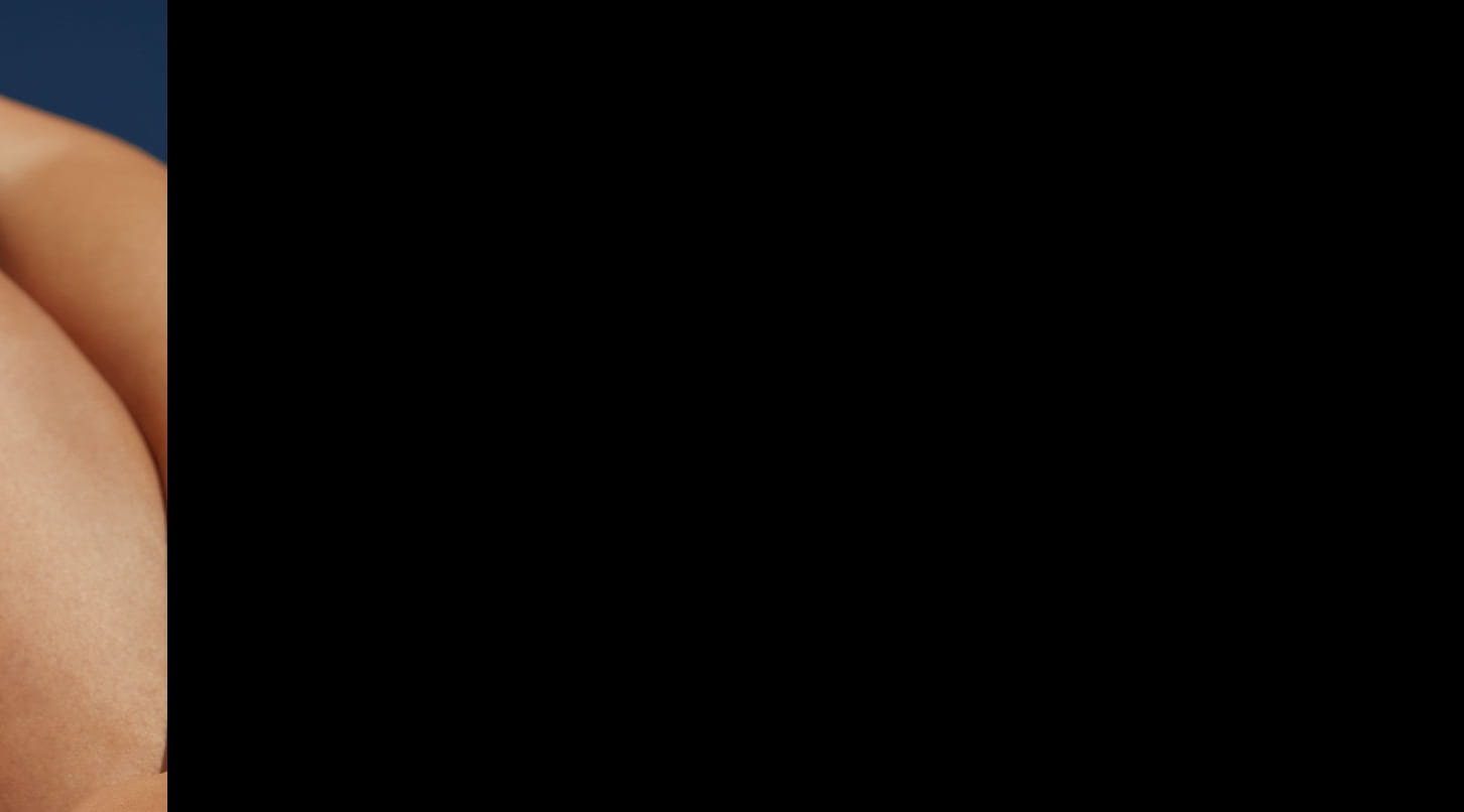 Dark circles under eyes