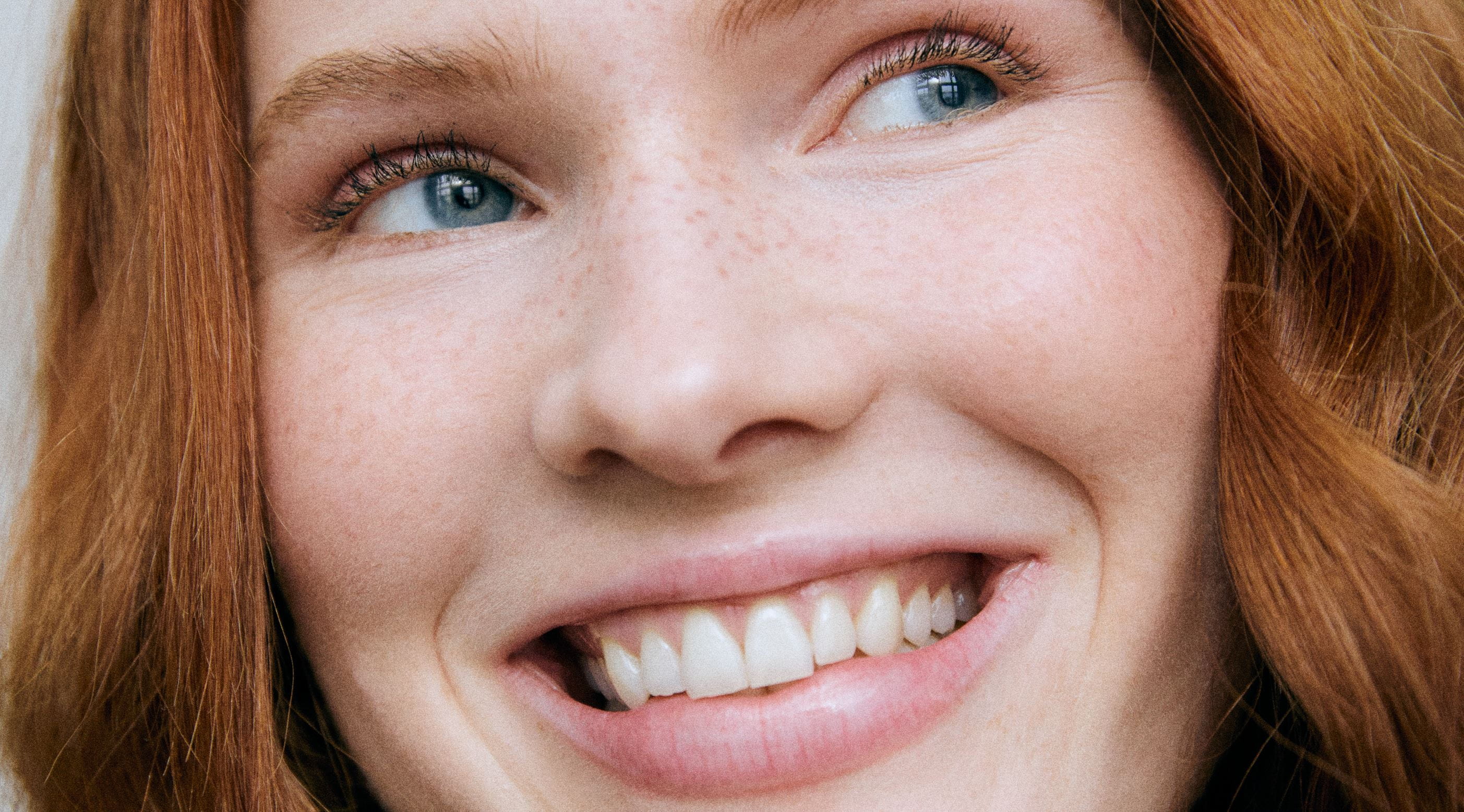 mulher com lábios hidratados