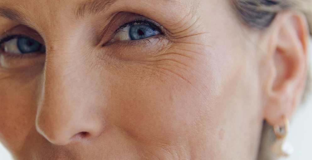 Close up of a woman's face with aging skin