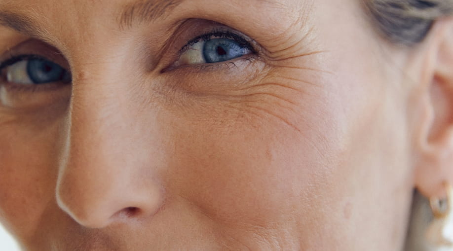 Close up of a woman's face with aging skin