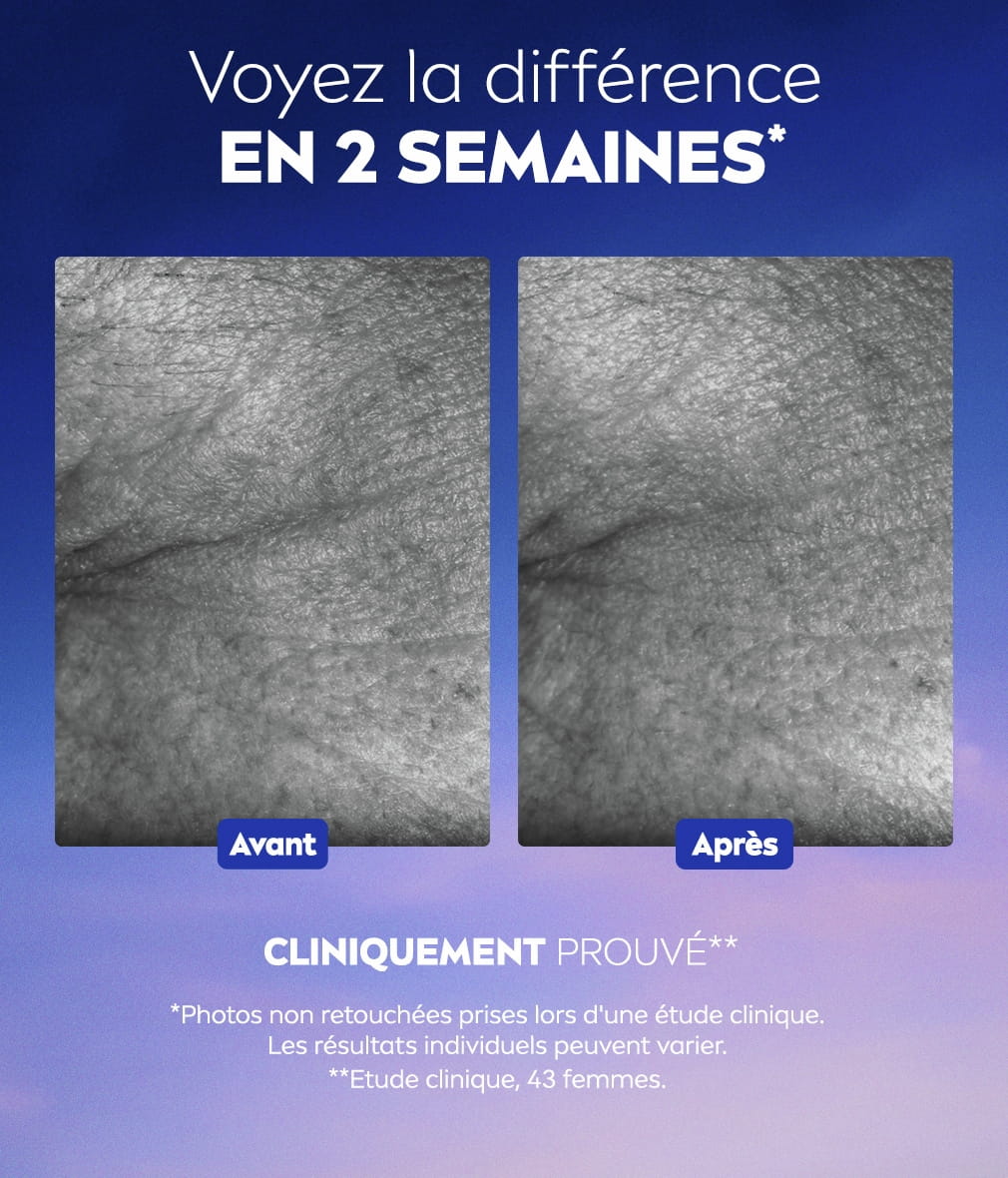 Une image avant/après compare deux photos des rides du coin des yeux, à côté du texte : « Voyez la différence en 2 semaines».