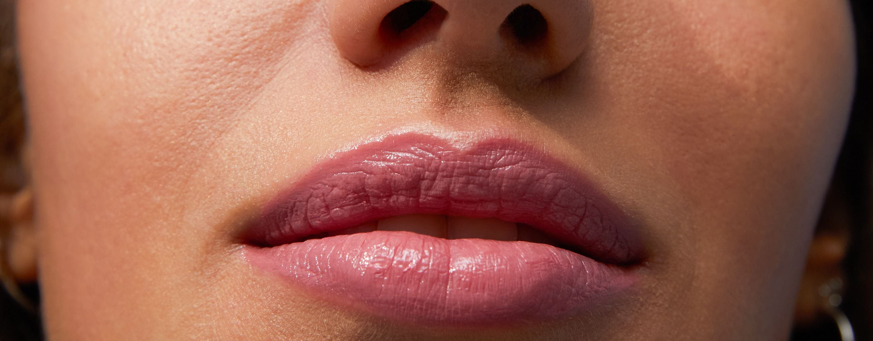 What Causes Dry & Chapped Lips