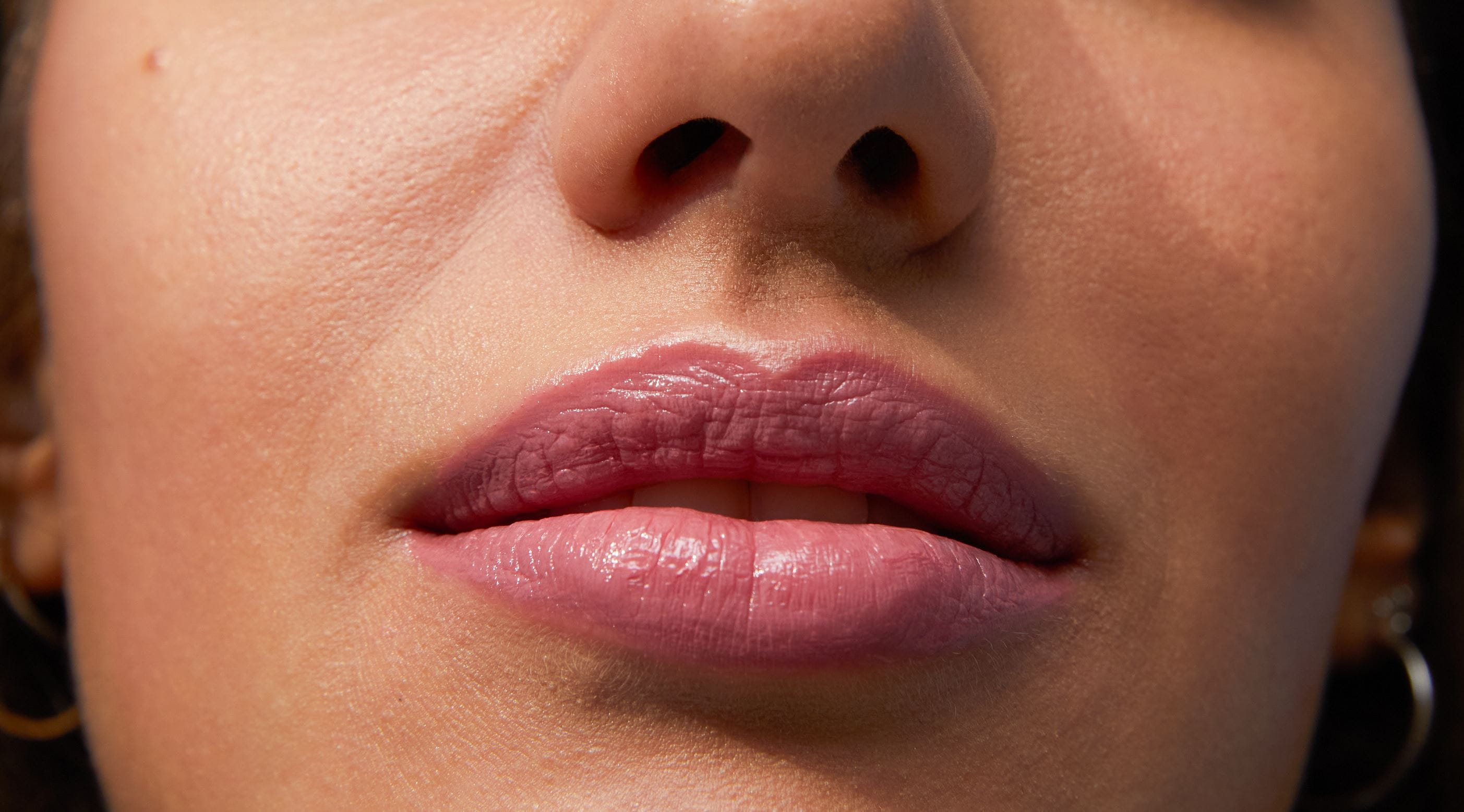 What Causes Dry & Chapped Lips