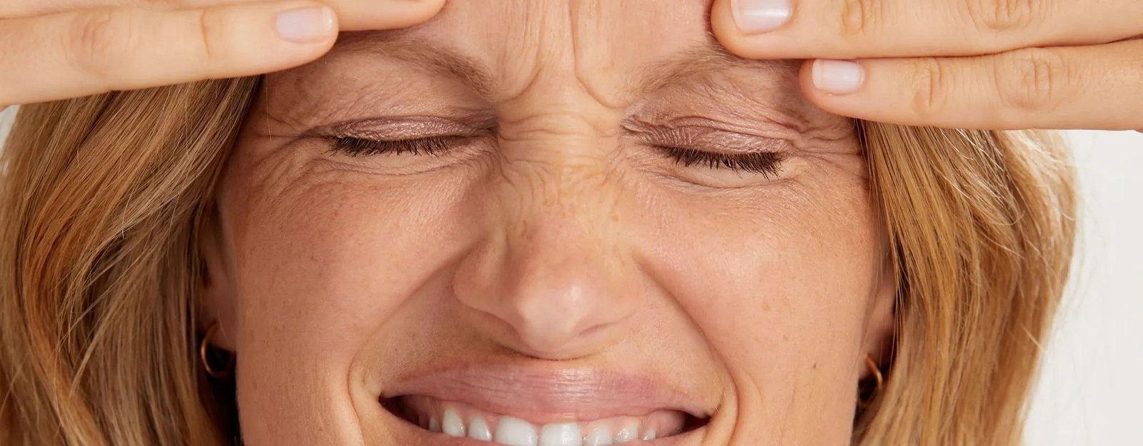 Blog Artigo 46 - Tratamento estético para linhas de expressão 390