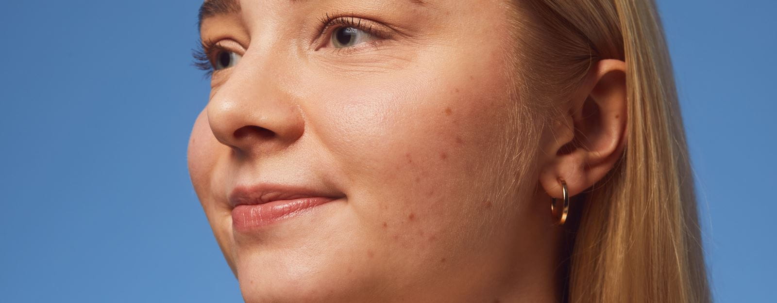 7 cause della pelle ruvida e come migliorarla | NIVEA