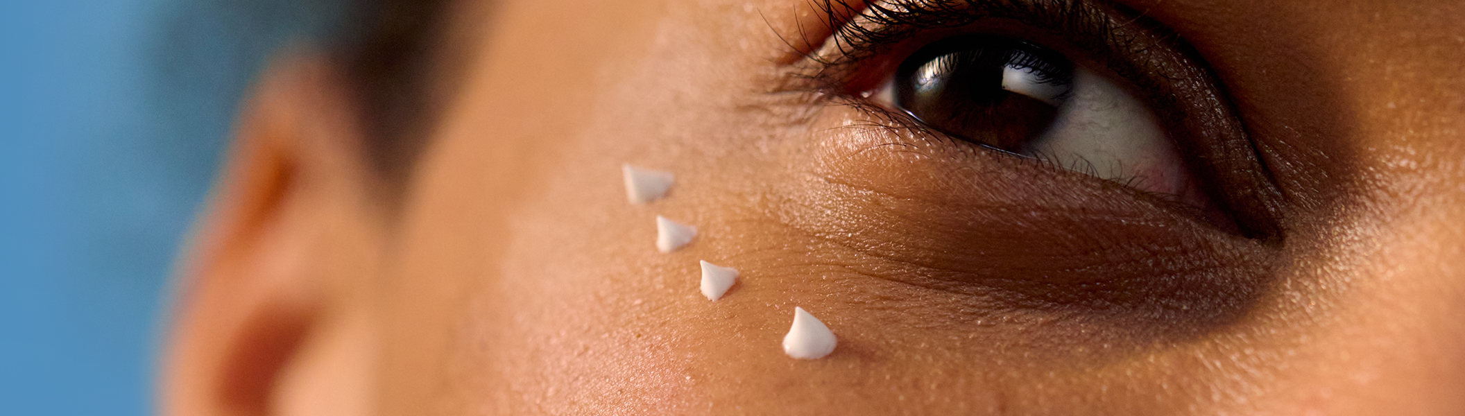 Hogyan szabaduljunk meg a szem alatti karikáktól 