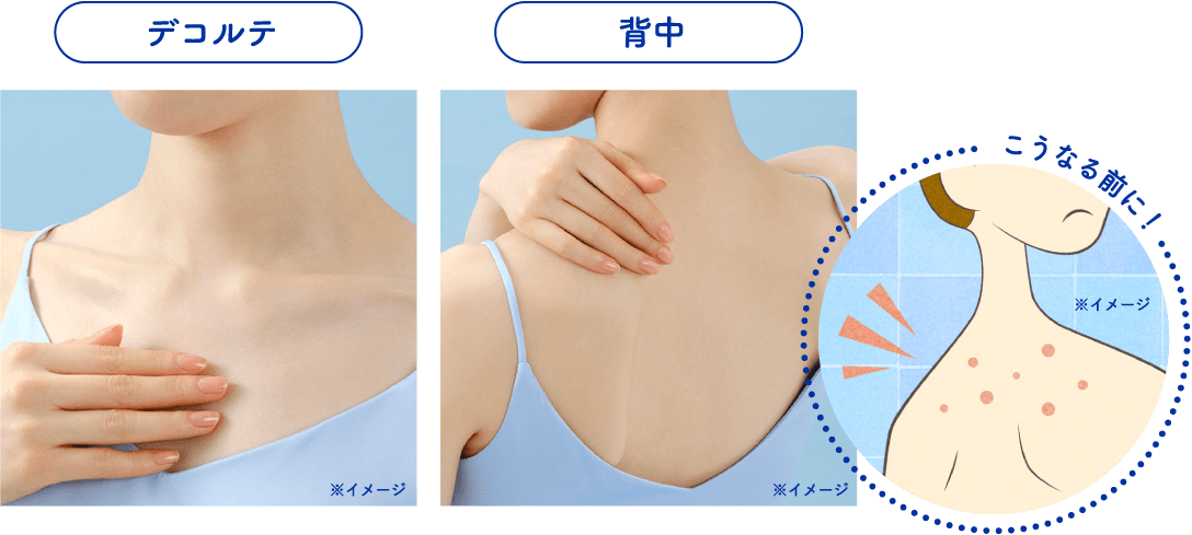 デコルテや背中にニキビができてしまう前に