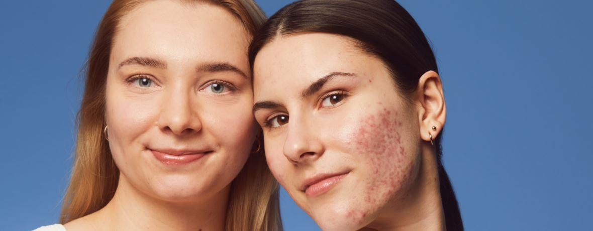 Vrouw zitten met haar armen gekruist