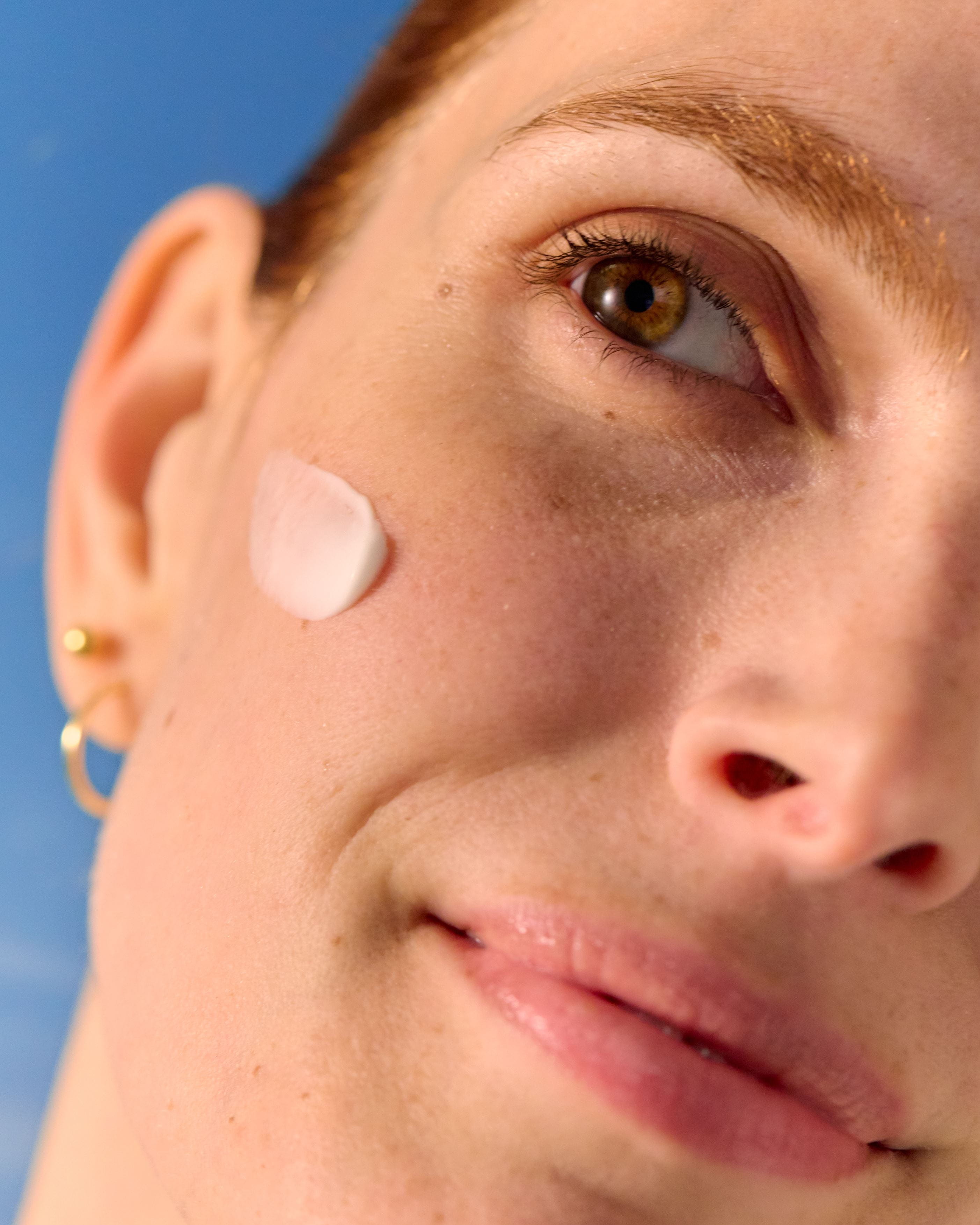 kvinne med milia i ansiktet