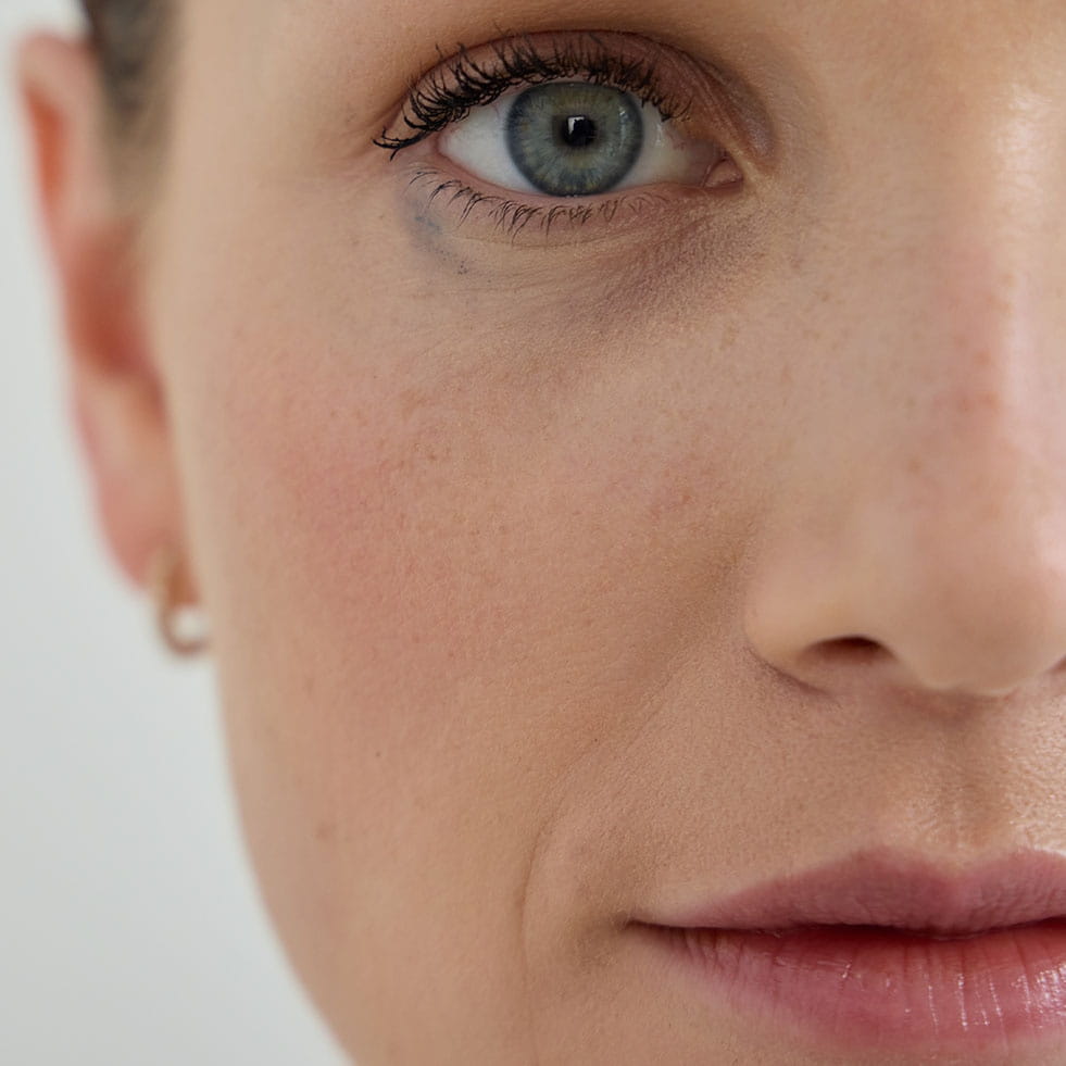 Kırışıklıklar ve düzensiz pigmentasyon gibi foto yaşlanmanın belirgin belirtilerini gösteren bir yüzün yakın çekimi