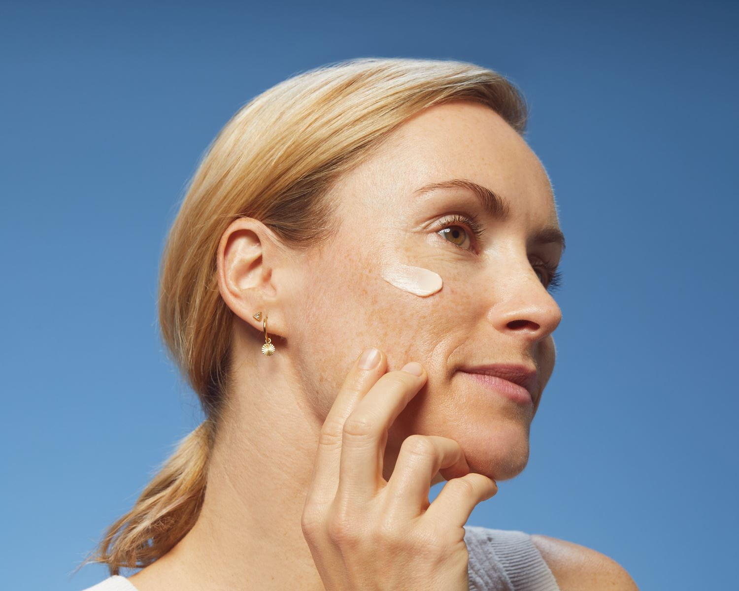How To Get Rid Of Dark Spots