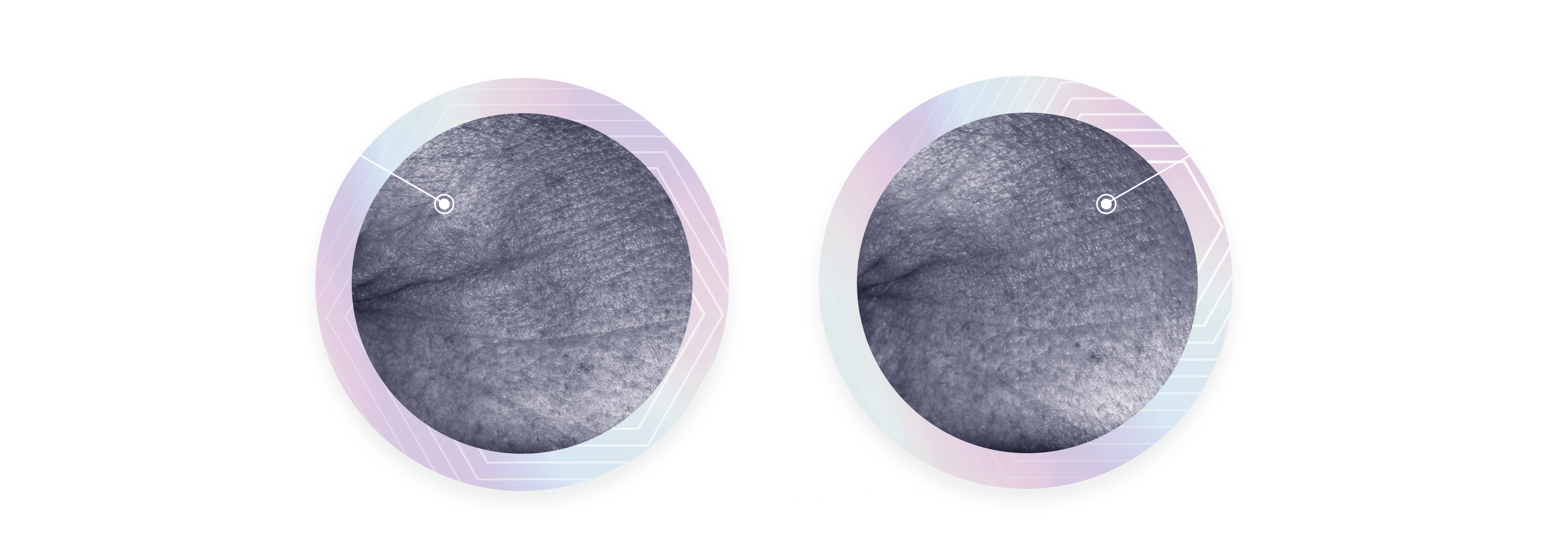 Uma imagem de antes e depois compara um par de imagens de rugas de pés-de-galinha