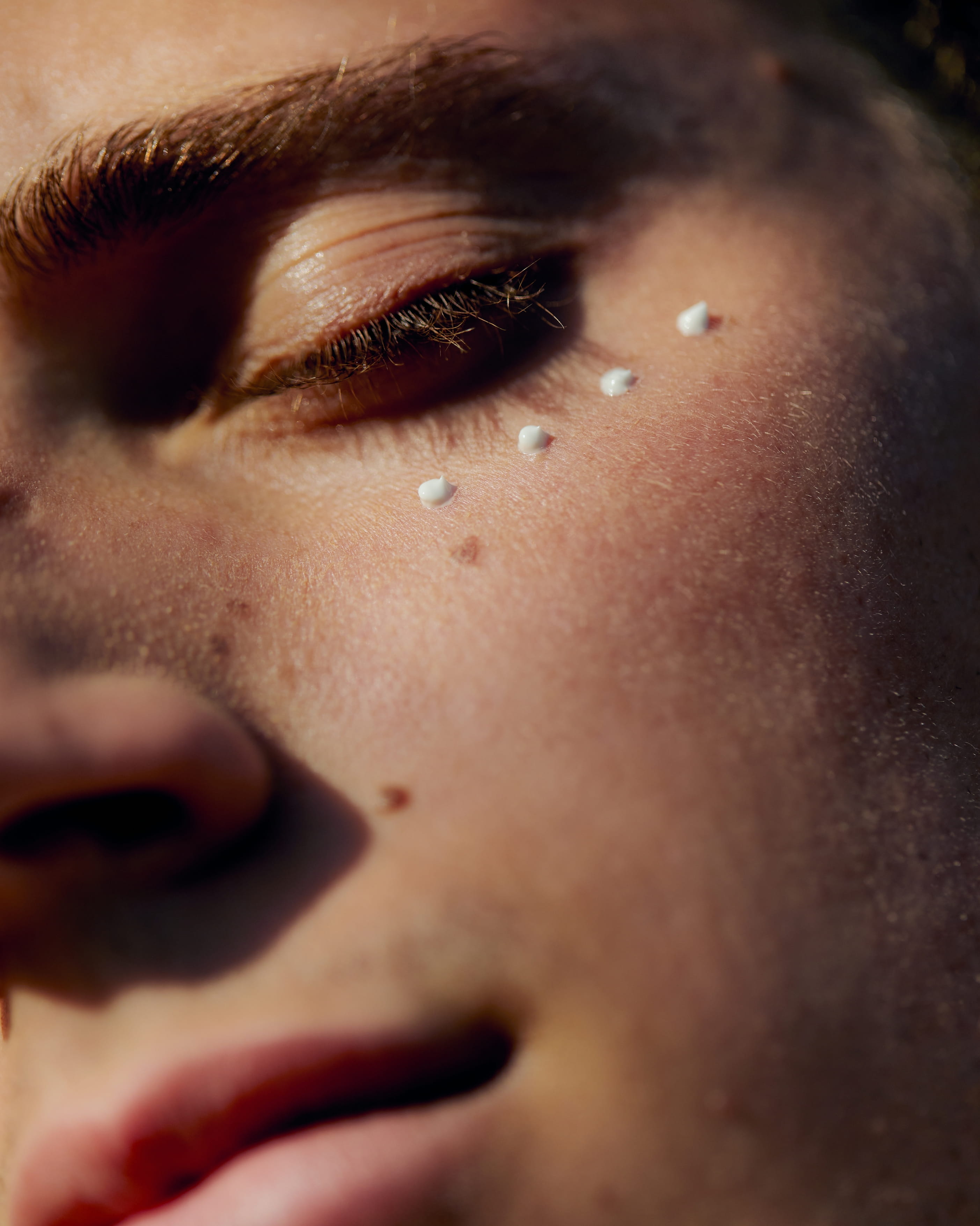 woman with spot treatment