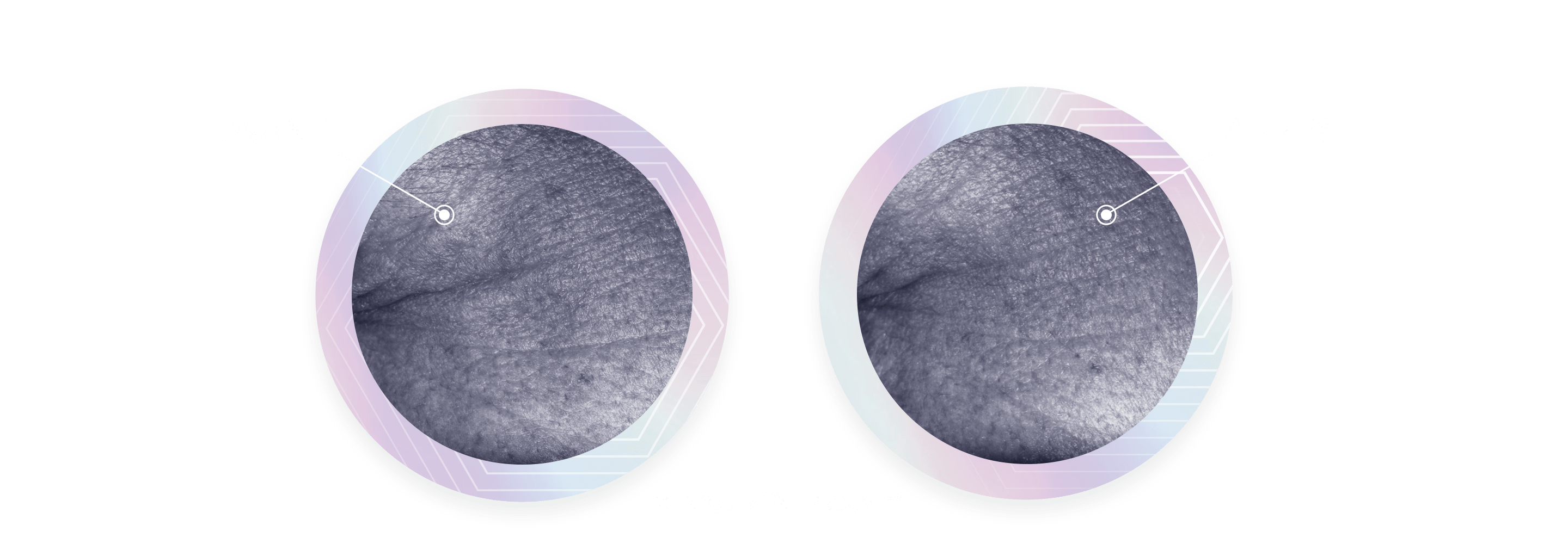 "Une image avant/après compare deux photos des rides du coin des yeux, à côté du texte : « Inversez les signes visibles de l'âge en 2 semaines »."