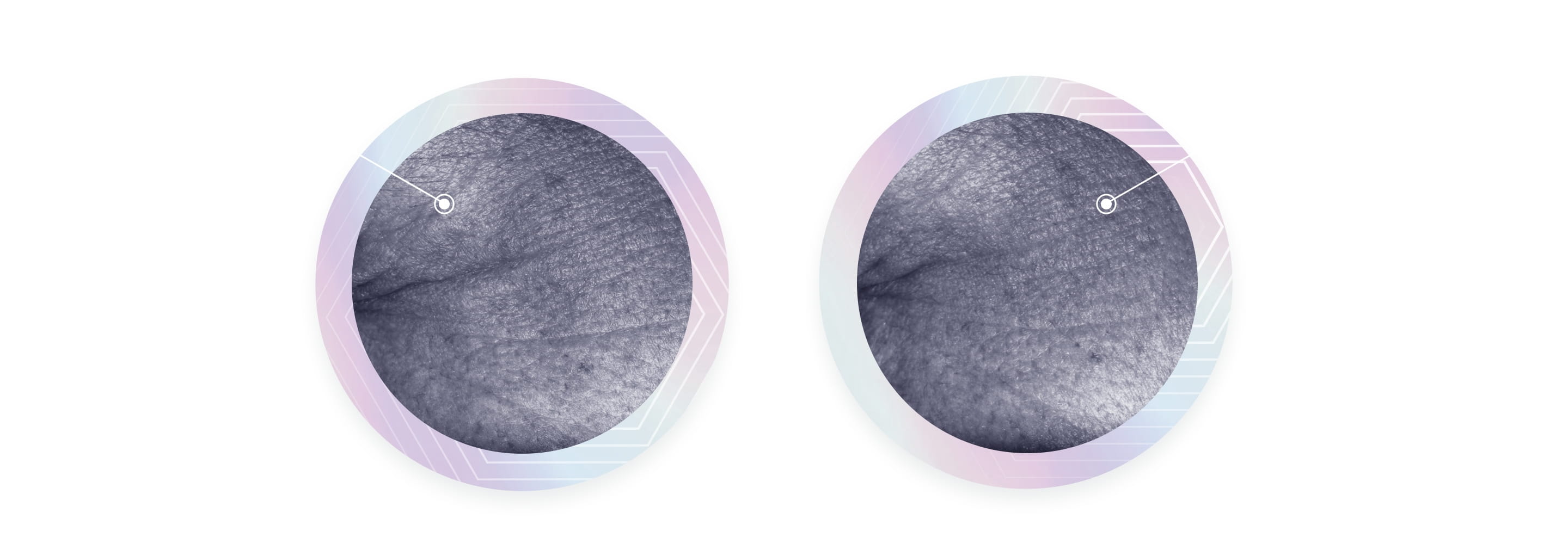 A before and after image compares a pair of images of crow's-feet wrinkles next to the text, "Reverse the signs of Ageing in 2 weeks".