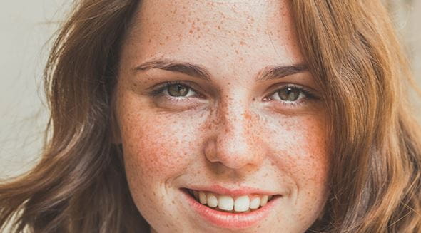 Junge Frau mit Sommersprossen