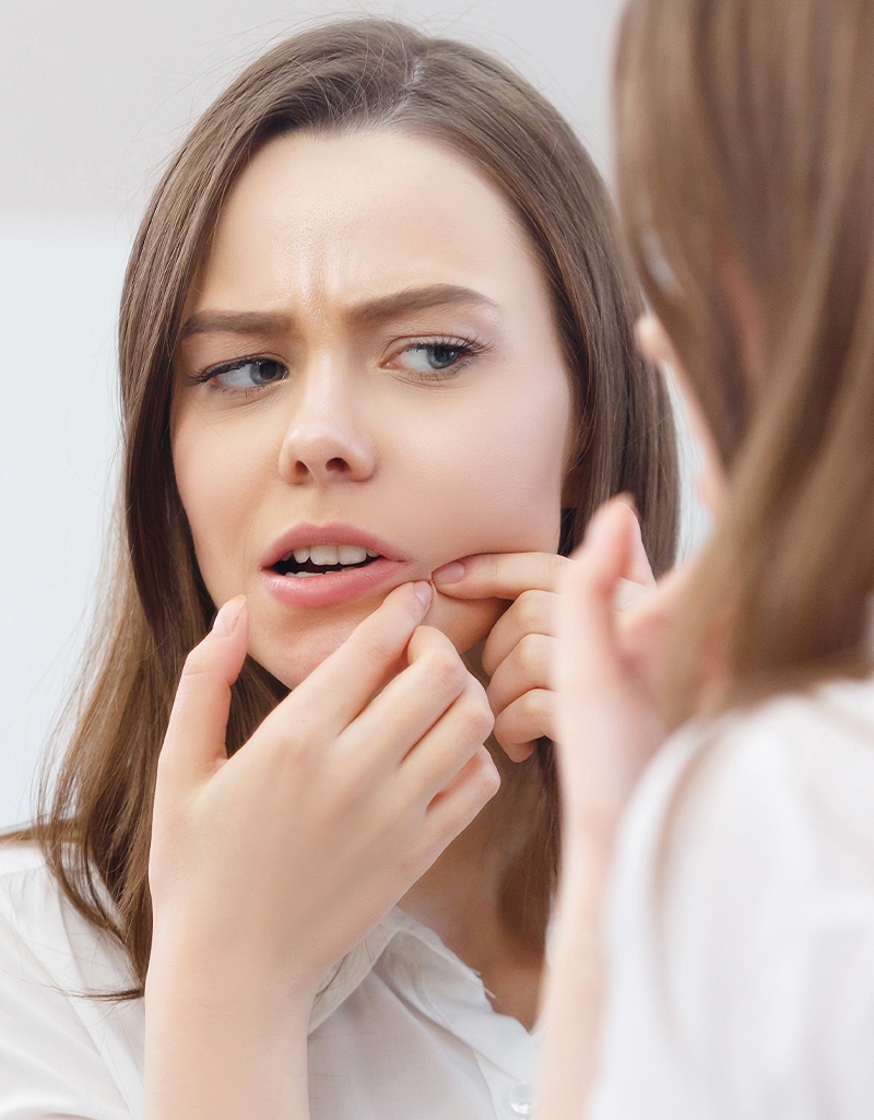 mujer sacando un grano de su rostro