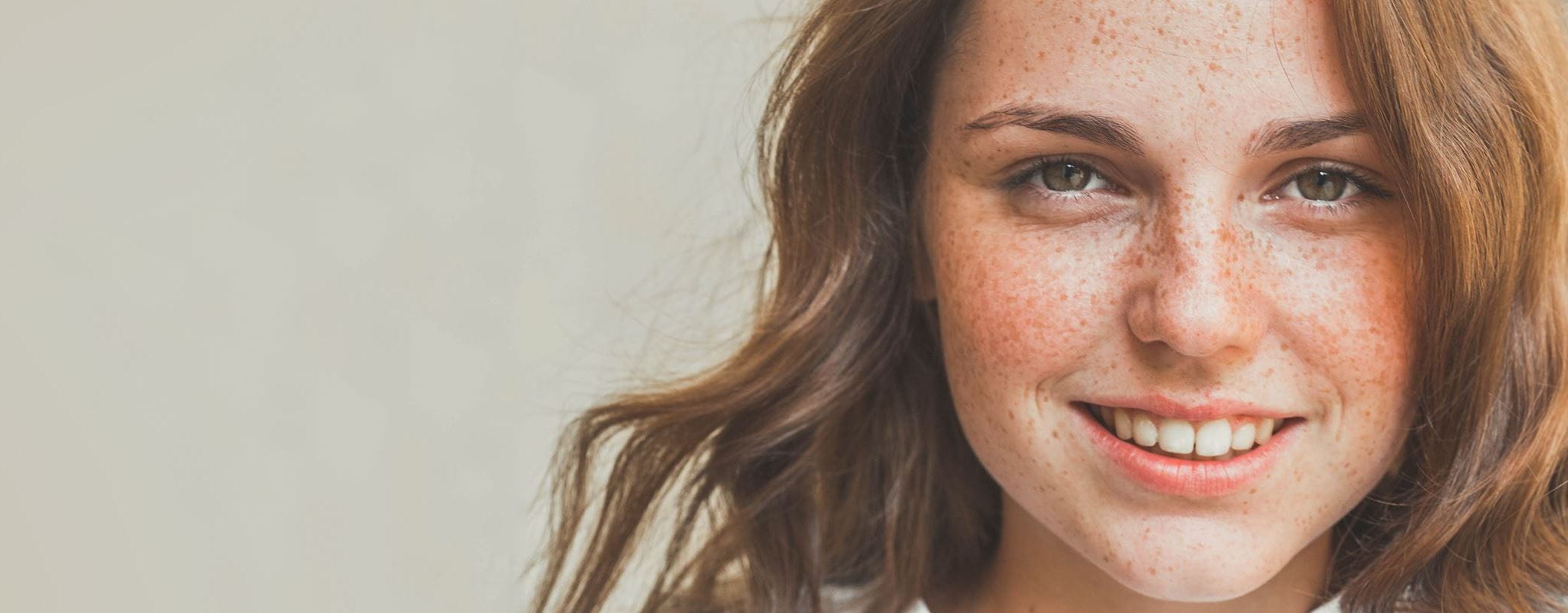 Freckles & Pigmentation