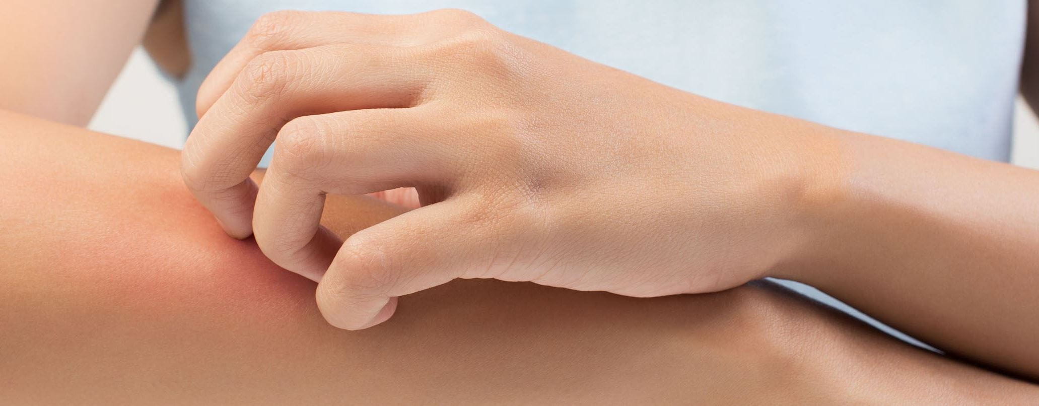 How To Prevent Itchy Skin