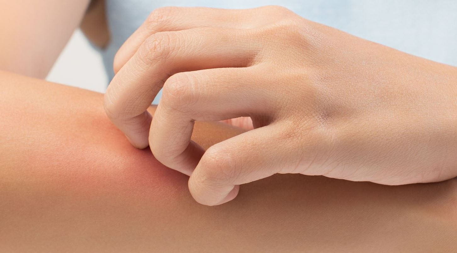 How To Prevent Itchy Skin