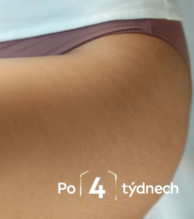 Po 4 týdnech