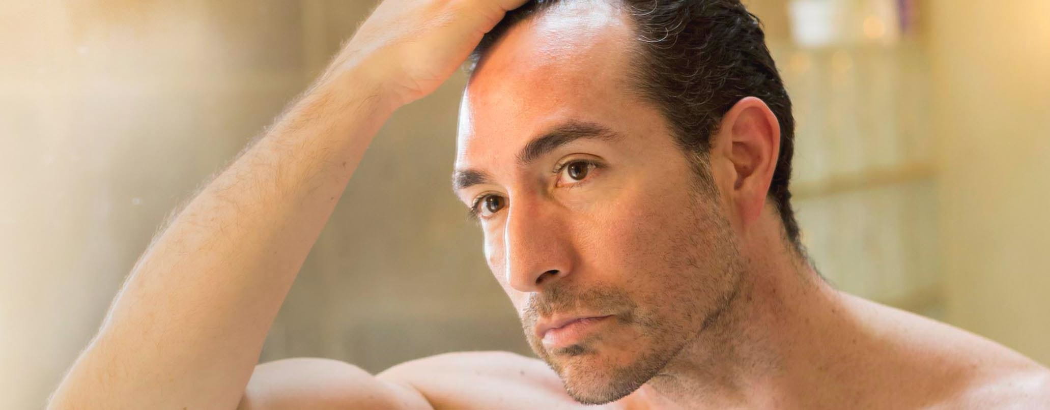 Haarausfall Männer