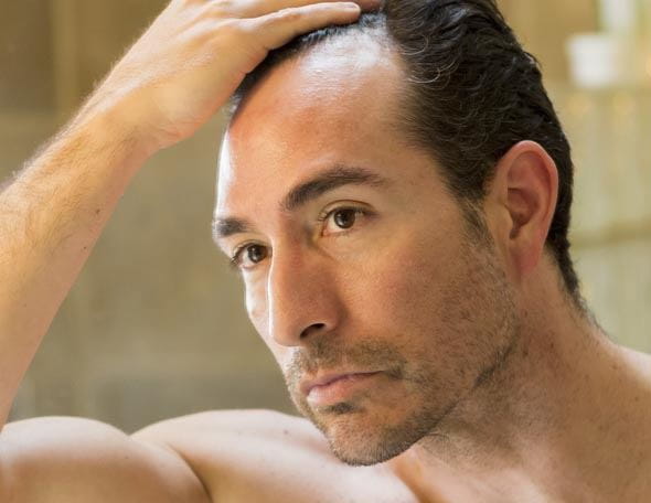 Haarausfall Männer