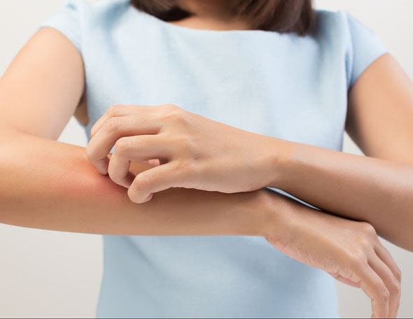 Ursachen für Juckreiz auf der Haut