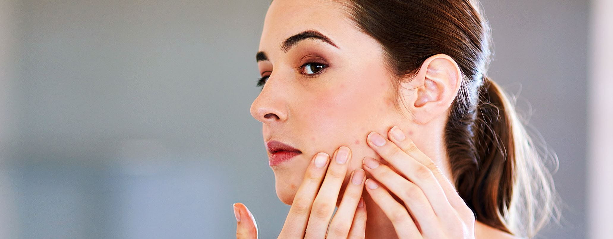 Pickelmale entfernen