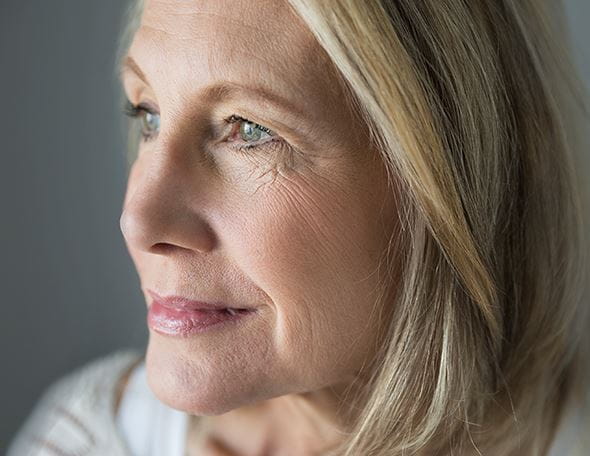 Marionettenfalten: Was hilft dagegen?